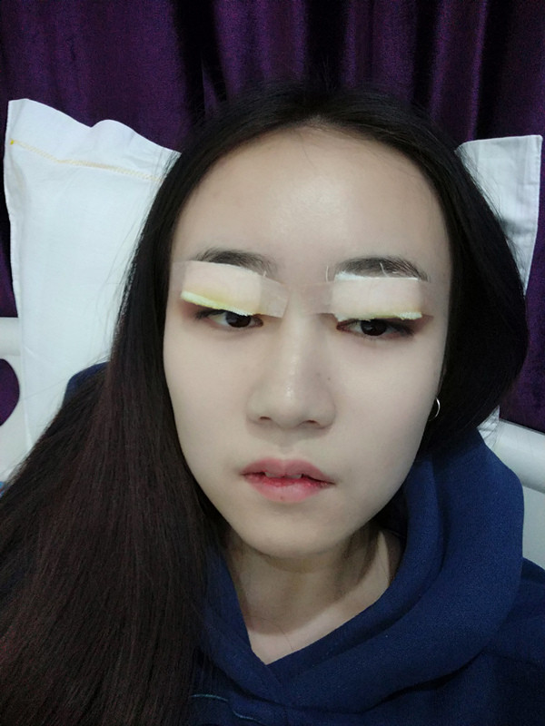 未成年医美消费人群逐年增加 法律该不该出手