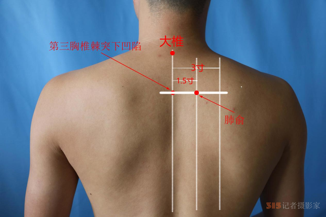 慢性咽炎不要慌，可用艾灸来帮忙
