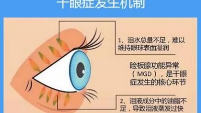 手机刷不停，怎样预防干眼症？