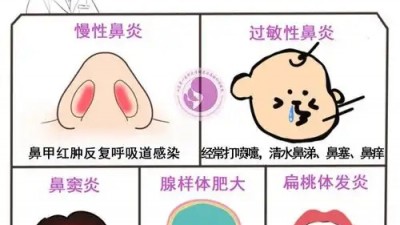 感冒还是过敏性鼻炎？教你3分钟自测
